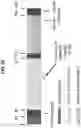 Fig. 44 - Biomarker pairs for predicting preterm birth