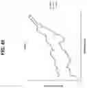 Fig. 47 - Biomarker pairs for predicting preterm birth