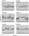 Fig. 07 - COMPOSITIONS AND METHODS FOR DETECTING PREDISPOSITION TO A SUBSTANCE USE DISORDER