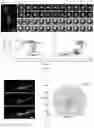 Fig. 02 - Recombinant and use thereof