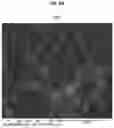 Fig. 07 - COATING METHOD OF APATITE USING LASER