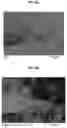 Fig. 10 - COATING METHOD OF APATITE USING LASER