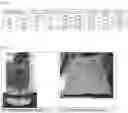 Fig. 04 - Method for manufacturing high purity tin, electrowinning apparatus for high purity tin and high purity tin