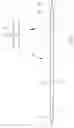 Fig. 02 - Knitting needle in particular for producing knitwear with cable patterns, and method for producing the knitting needle