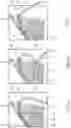 Fig. 05 - Knitting needle in particular for producing knitwear with cable patterns, and method for producing the knitting needle