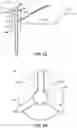 Fig. 06 - Integrated pile anchor reinforcement systems