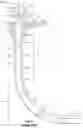 Fig. 02 - Apparatus and method for running casing into a wellbore