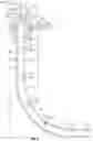 Fig. 03 - Apparatus and method for running casing into a wellbore