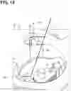 Fig. 12 - Cooling water control valve device