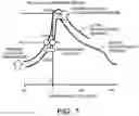 Fig. 05 - Exhaust gas purification system for internal combustion engine