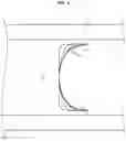 Fig. 05 - Reinforced axial diffuser