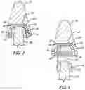 Fig. 04 - Treatment element attachment system
