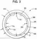Fig. 04 - Anti pull-out collar for a ball joint