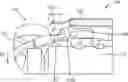 Fig. 01 - Motor vehicle component displacement limiting system and method