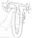 Fig. 01 - Device and method for repairing pipe leakage