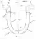 Fig. 02 - Device and method for repairing pipe leakage