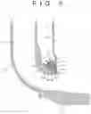 Fig. 04 - Heating device