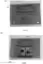 Fig. 05 - Fully redundant position sensor