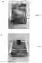 Fig. 07 - Fully redundant position sensor