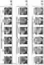 Fig. 04 - Systems for detecting vascular and arterial disease in asymptomatic patients and related methods