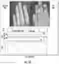 Fig. 06 - Systems for detecting vascular and arterial disease in asymptomatic patients and related methods