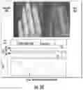 Fig. 07 - Systems for detecting vascular and arterial disease in asymptomatic patients and related methods