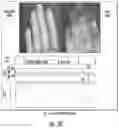 Fig. 08 - Systems for detecting vascular and arterial disease in asymptomatic patients and related methods