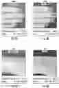 Fig. 11 - Systems for detecting vascular and arterial disease in asymptomatic patients and related methods