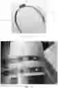 Fig. 18 - Systems, devices and methods for testing substrates to evaluate wound closure products
