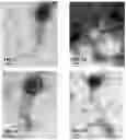 Fig. 03 - Bacteriophage-based electrochemical biosensor