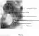 Fig. 04 - Bacteriophage-based electrochemical biosensor