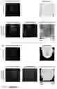 Fig. 06 - KITS, METHODS AND THEIR USES FOR DETECTING CELL-CELL INTERACTIONS IN A SAMPLE KITS