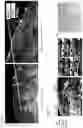 Fig. 03 - A METHOD FOR CHARACTERIZING MELANOCYTIC LESIONS