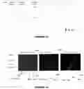 Fig. 08 - BLADDER CANCER DETECTION DEVICE AND METHOD