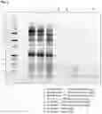 Fig. 04 - Method for preparing peptide fragments, kit for preparing peptide fragments to be used therein, and analysis method