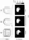Fig. 03 - Dipole antenna assembly for capturing images by means of nuclear magnetic resonance methods