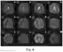 Fig. 05 - Method and apparatus for determining optimal magnetic resonance imaging scan nesting manner