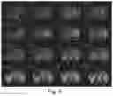 Fig. 06 - Method and apparatus for determining optimal magnetic resonance imaging scan nesting manner