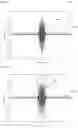 Fig. 10 - Radar interference detection