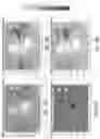 Fig. 10 - Glare mitigation in LIDAR applications