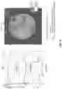 Fig. 06 - Correcting eccentering effect in pulse-echo imaging
