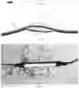 Fig. 04 - Fiber optic sensor and system including a fiber of an optical cable as a sensor fiber