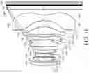 Fig. 12 - Photographing optical lens system, image capturing unit and electronic device