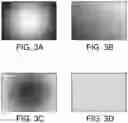 Fig. 03 - Apparatus and method to reduce vignetting in microscopic imaging