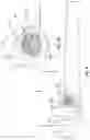 Fig. 05 - Process for mounting an elastic hinge on eyeglass frames