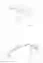 Fig. 10 - Glasses comprising biosensors