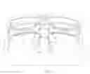 Fig. 13 - Glasses comprising biosensors