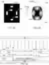 Fig. 04 - System and method for illuminating edges of an imprint field with a gradient dosage