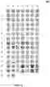 Fig. 05 - EMOJI PREDICTION AND VISUAL SENTIMENT ANALYSIS