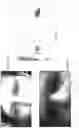 Fig. 03 - Image processing method and system for iris recognition